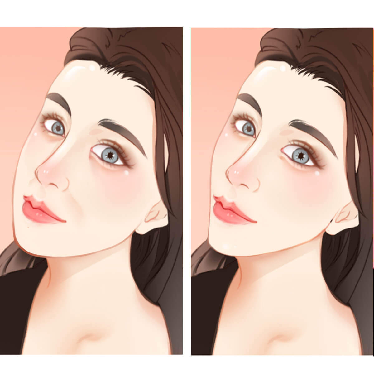 Non-surgical facelift vs surgical facelift