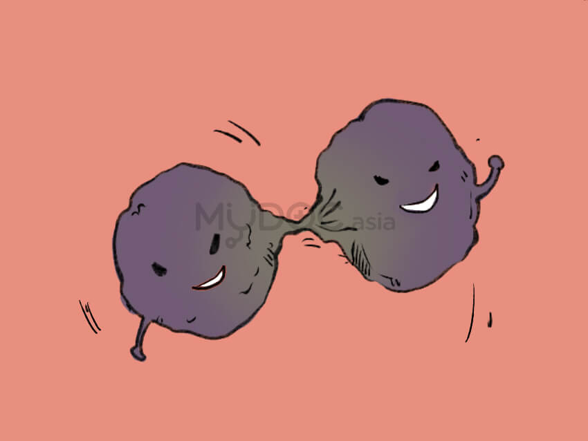 Cervical cancer can spread to the surrounding organs and other parts of the body