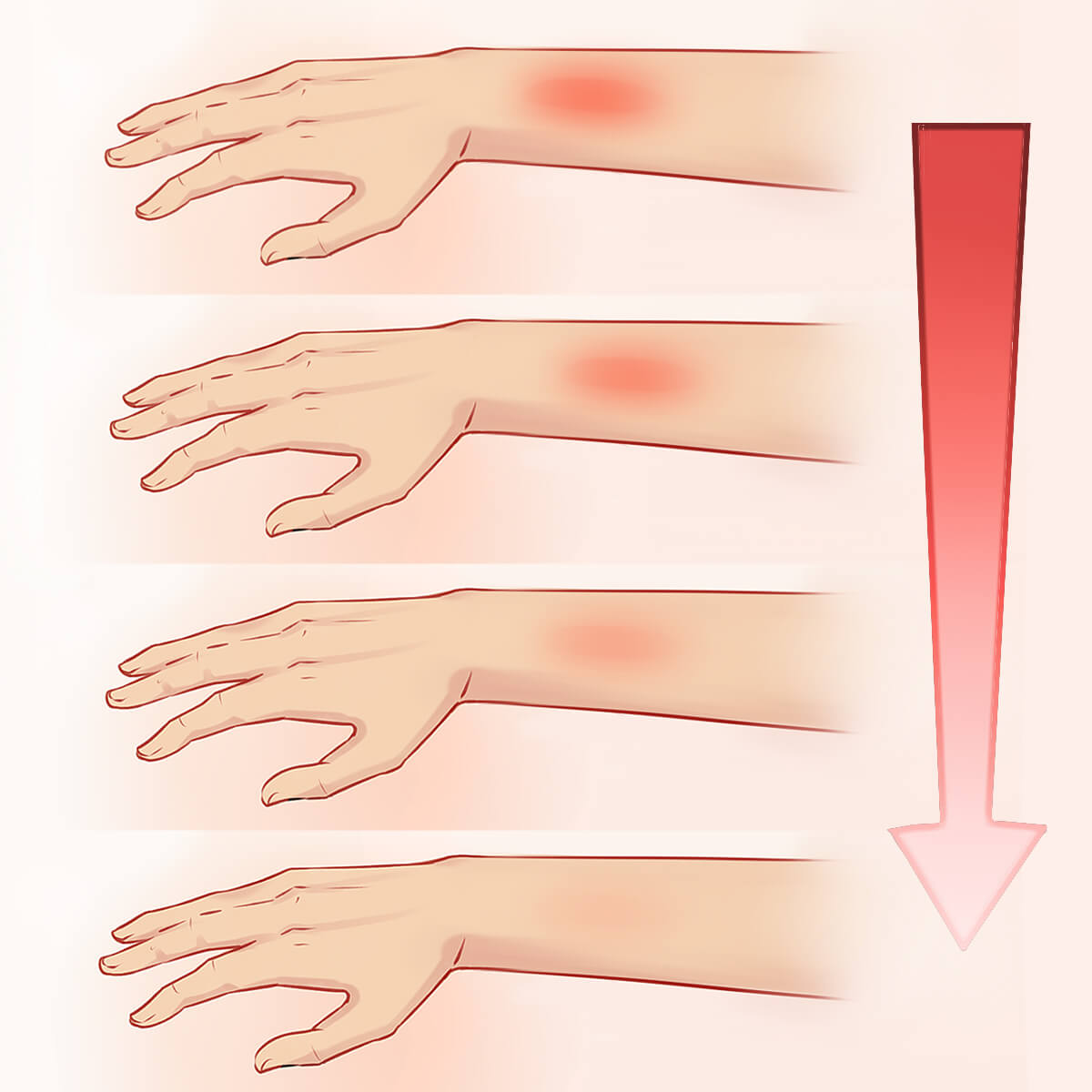 After a tattoo removal