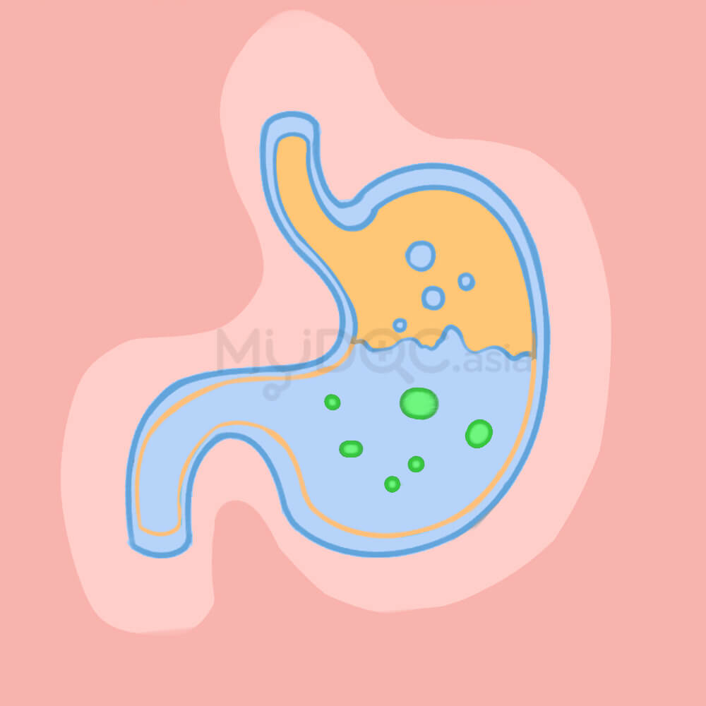 stomach acid