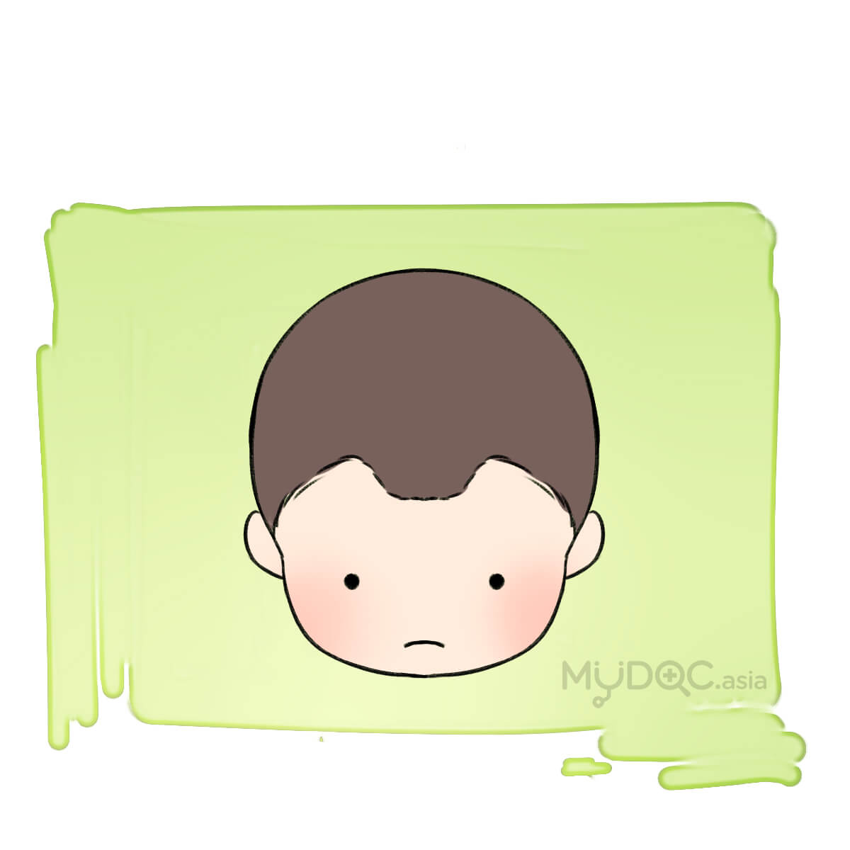 M-shape hair loss