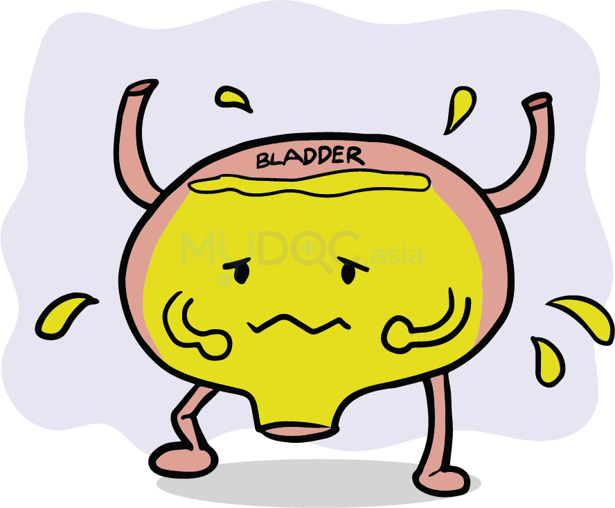 Overflow incontinence of urine icd 10 sherytrainer