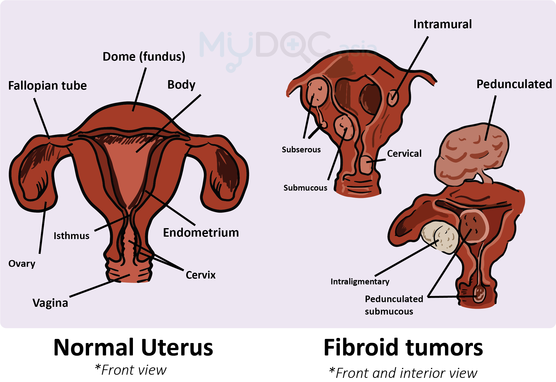 Kelahiran Semulajadi atau Pembedahan Caesarean? Erufu Care