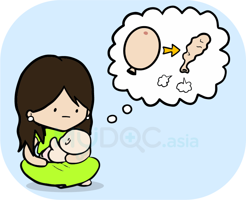 breast sagging after breatfeeding