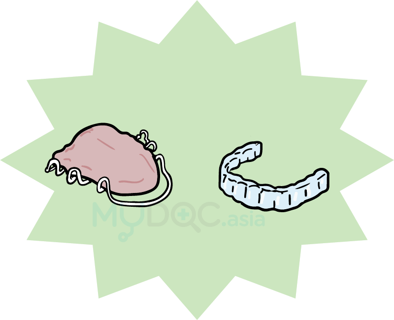 Hawley retainers and VFRs