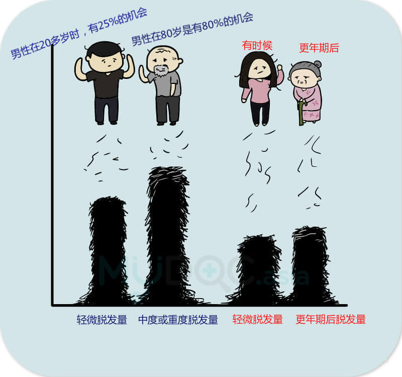 男性和女性的脱发量