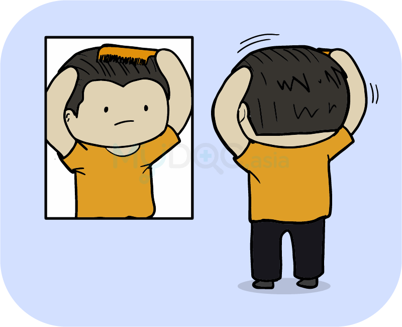 Identifying Your Hair Loss