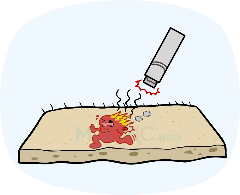 Tattoo Removal with Heat (The Use of Infrared Coagulation)