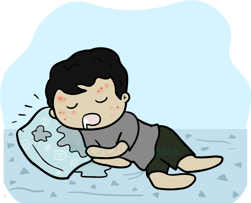 9 bad habits you need to quit to get rid of pimples! Erufu Care