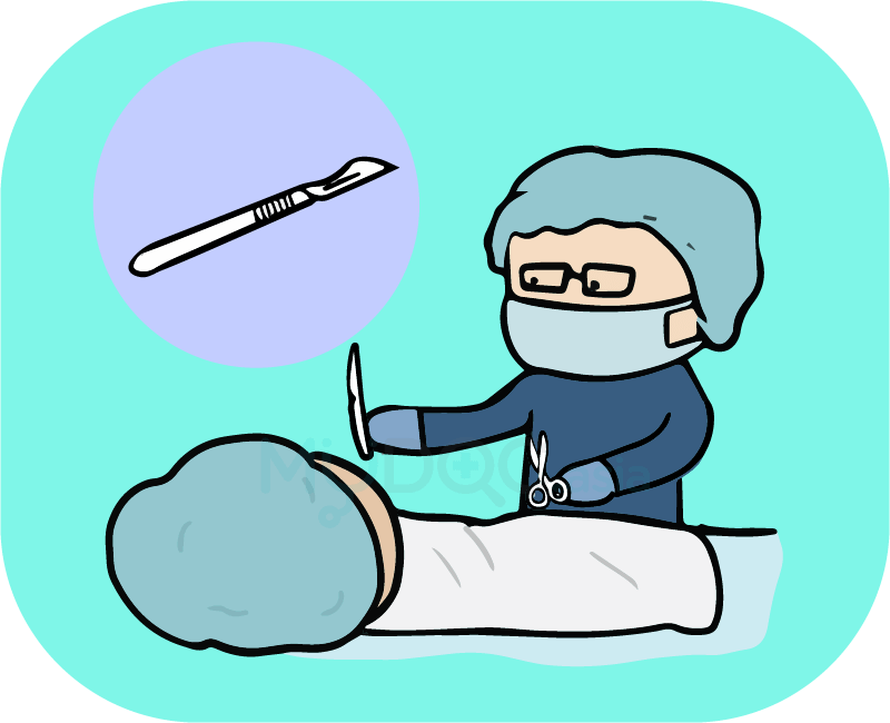 body odor surgery in malaysia