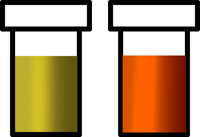 Dark coloured urine as a symptom of liver damage