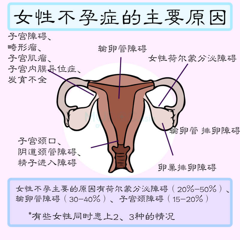 女性不孕的原因