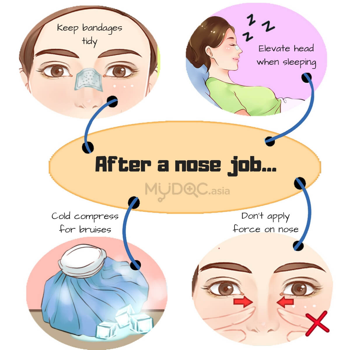 Nose jobs post care