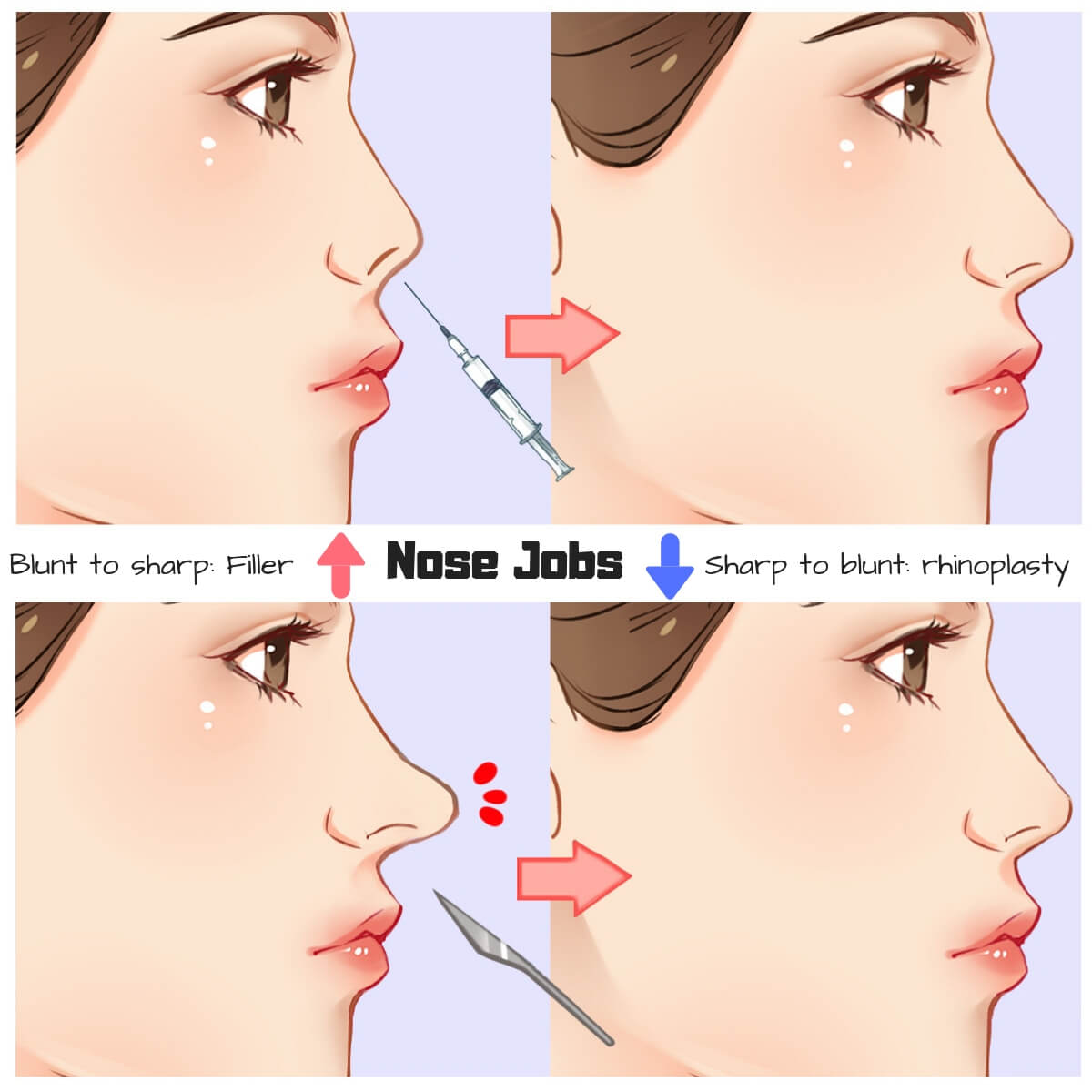 Nose tip