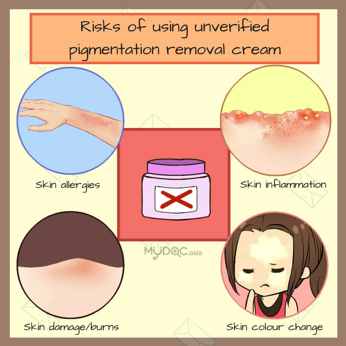 Risk of pigmentation cream