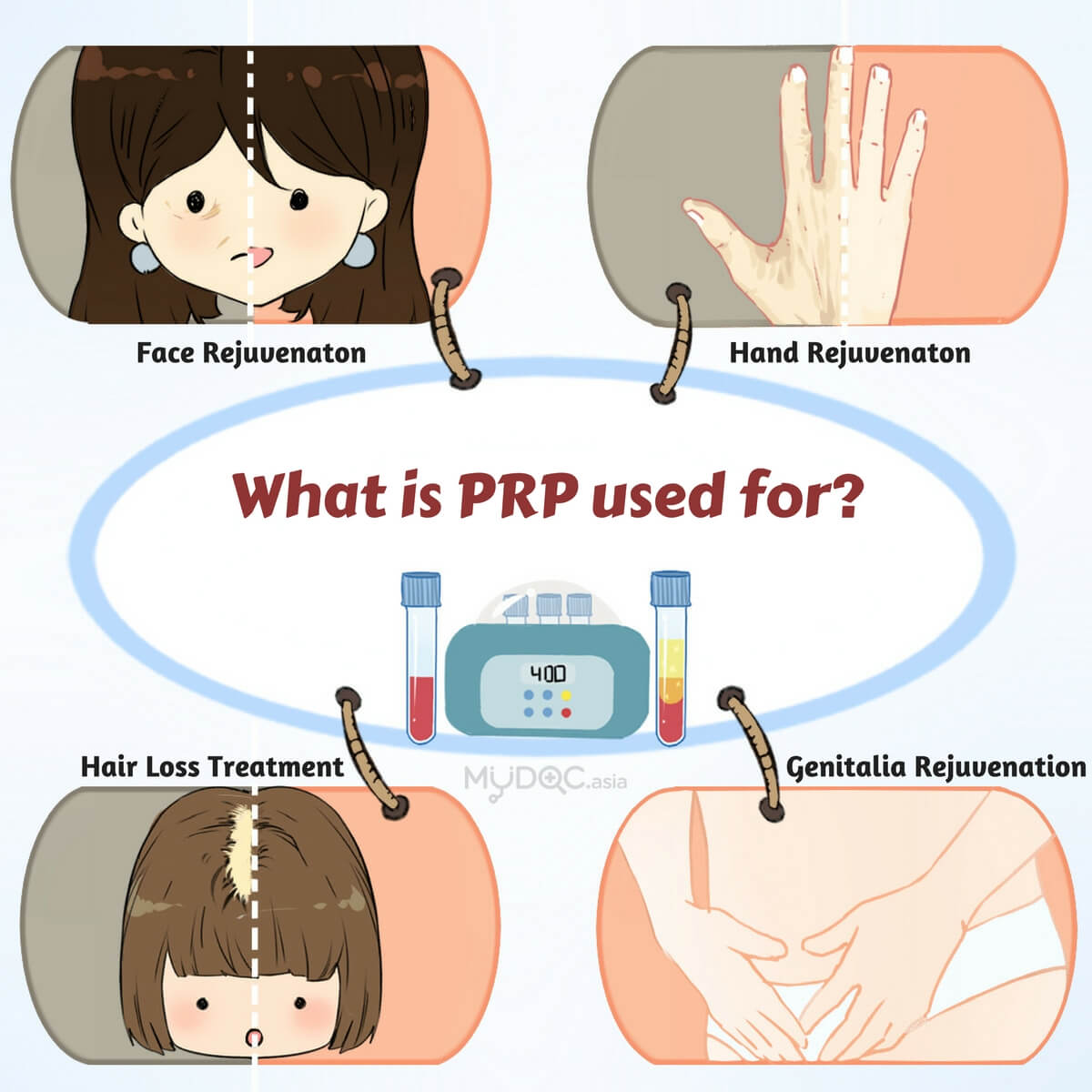 What is PRP used for