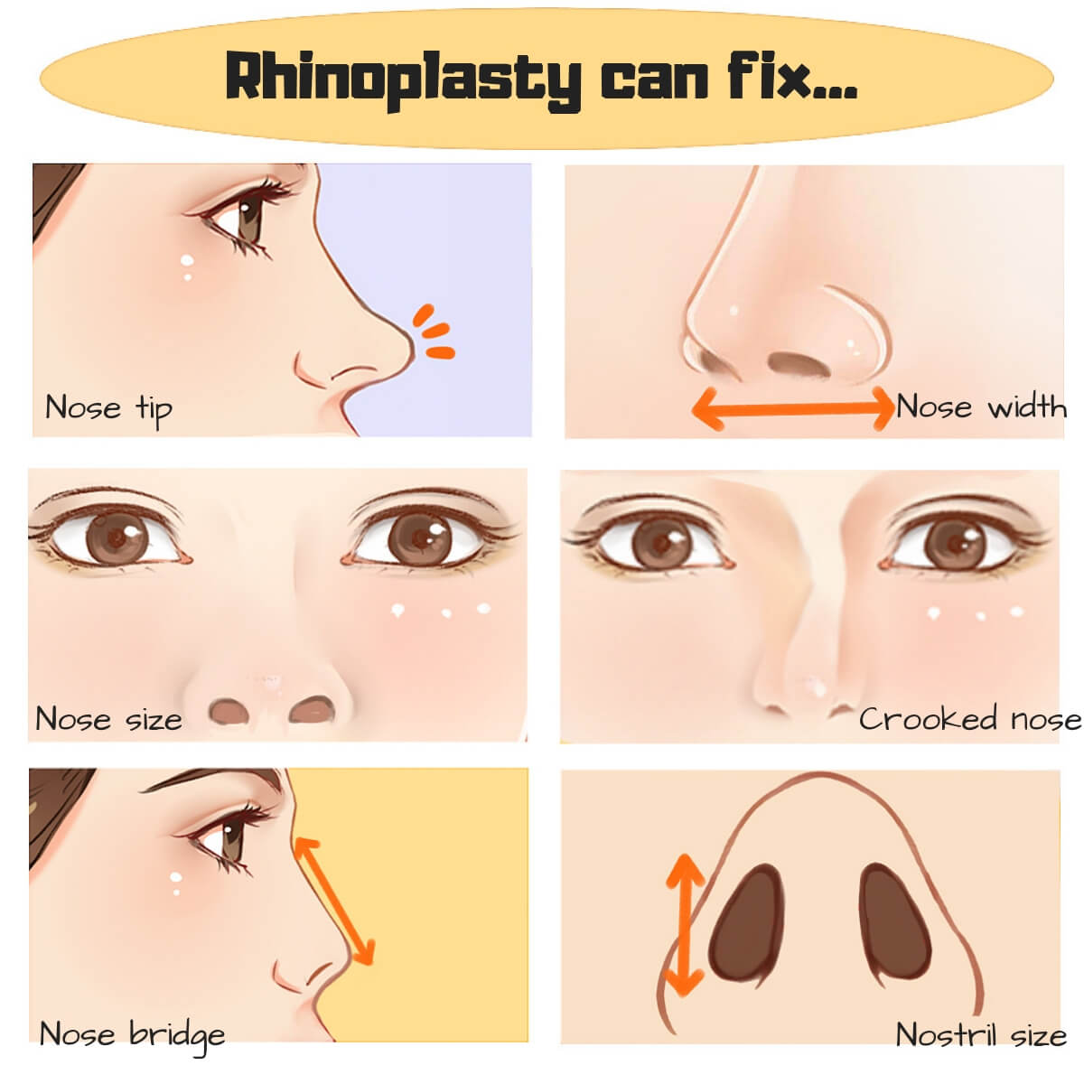 Non surgical nose job bulbous tip deals