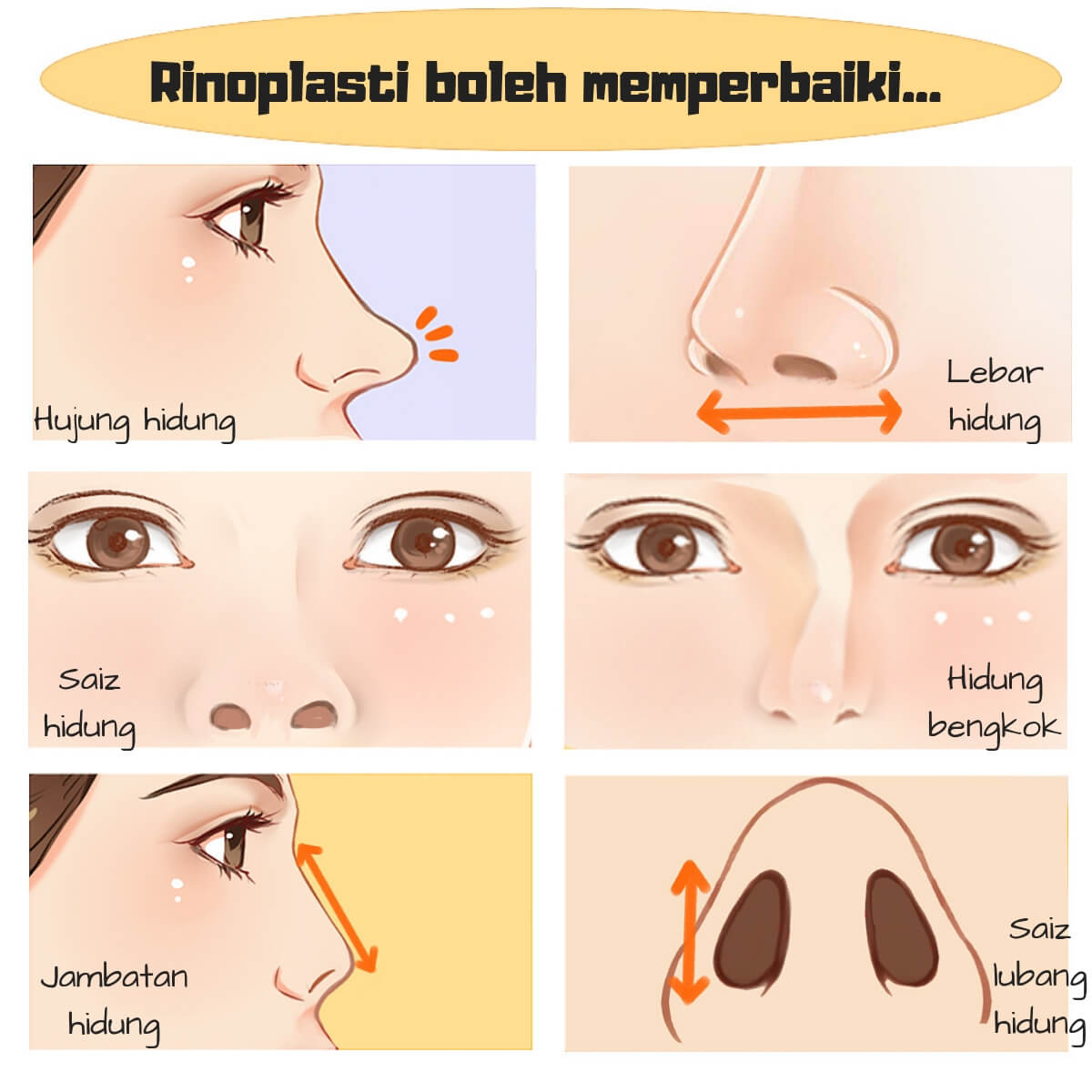 Hidung tinggi maksud