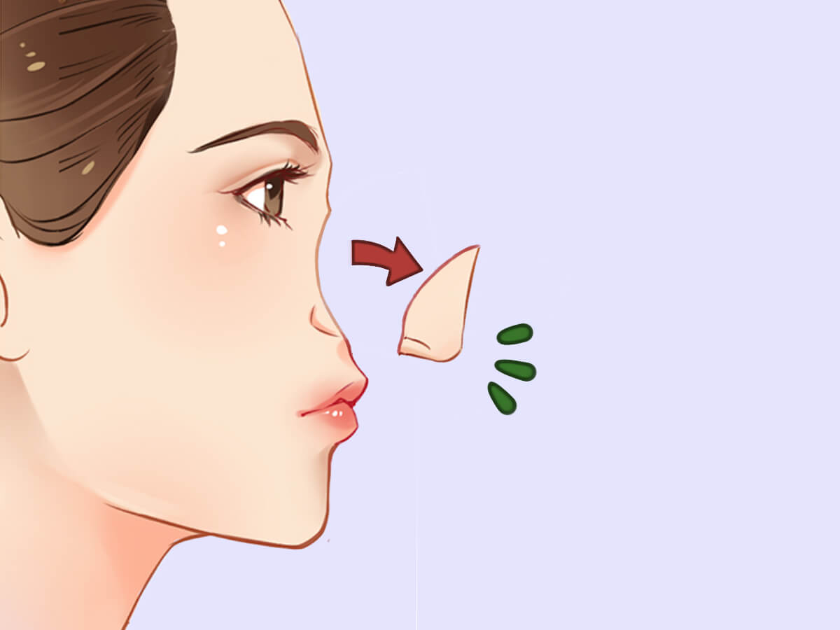 Will My Nose "Drop" After a Nose Job? Erufu Care