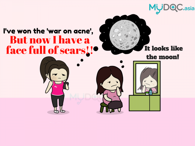 After Battling Acne, My Face is Now Full of Acne Scars