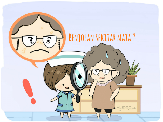 Xanthelasma - Apa Benjolan Di Sekitar Mata Saya?