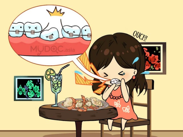 Top 5 habits that may cause you braces injuries!