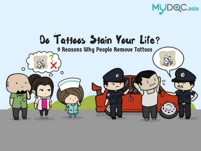9 Reasons Why People Remove Their Tattoos