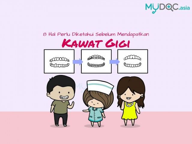 8 Hal Perlu Diketahui Sebelum Mendapatkan Kawat Gigi, Braket Lutsinar serta Penahan Gigi
