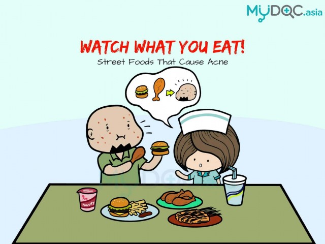 Watch What You Eat! Street Foods that Cause More Acnes!