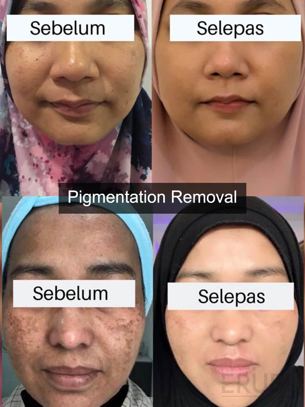 Regalion Clinic Kepong - Medical Aesthetics u0026 Anti-Aging, Skin 