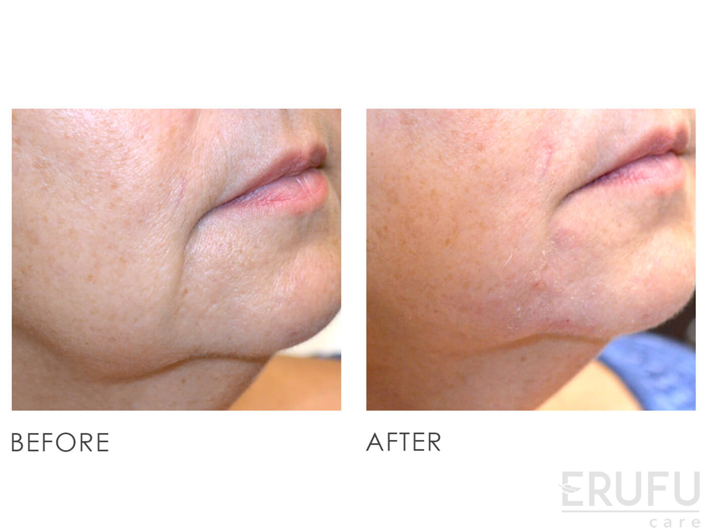Premier Clinic (KL City) Medical Aesthetics, Skin (Dermatology) Clinic in Kuala Lumpur, Malaysia Premier Clinic (KL City) Medical Aesthetics, Skin (Dermatology) Clinic in Kuala Lumpur, Malaysia