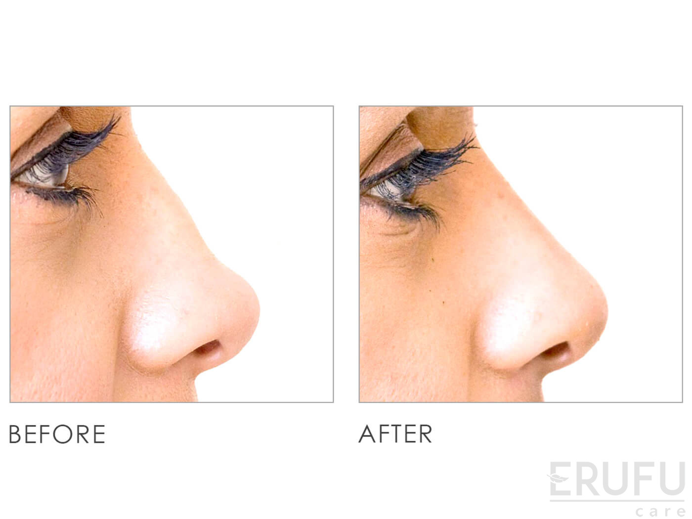Premier Clinic (KL City) Medical Aesthetics, Skin (Dermatology) Clinic in Kuala Lumpur, Malaysia Premier Clinic (KL City) Medical Aesthetics, Skin (Dermatology) Clinic in Kuala Lumpur, Malaysia