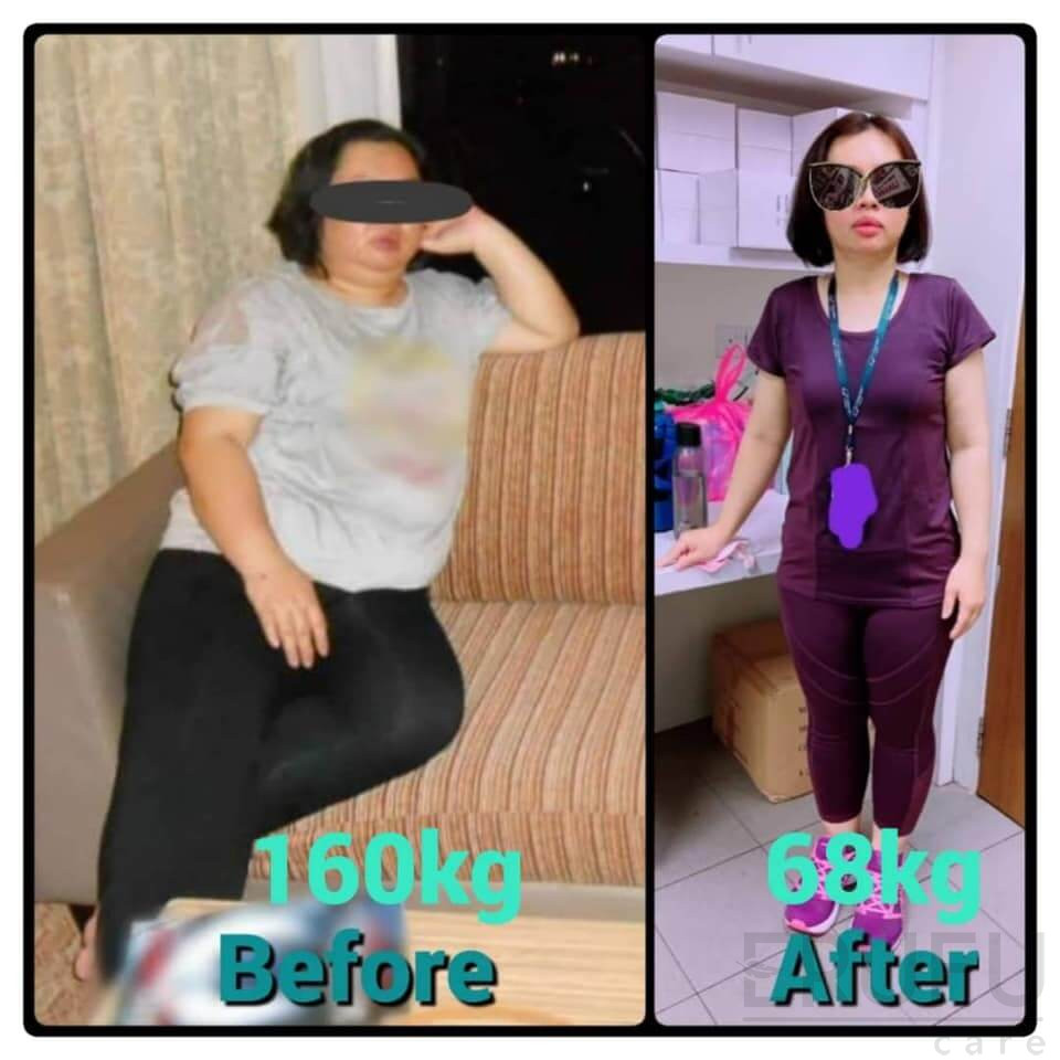 3 Klinik Rawatan Buasir Dengan Laser (LHP) Terbaik Malaysia 