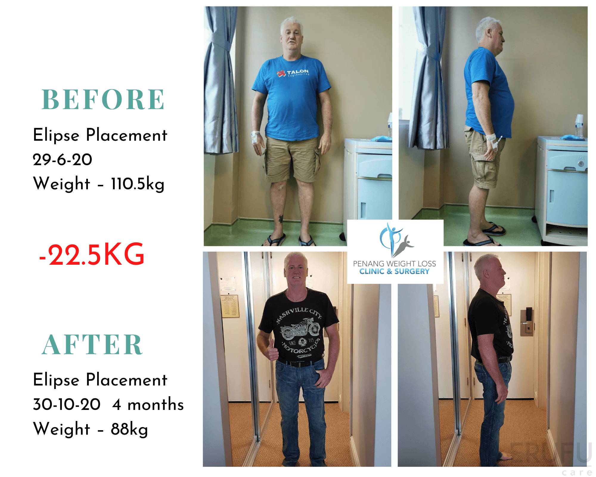 3 Klinik Pembedahan Am Terbaik Pulau Pinang - Harga u0026 Ulasan