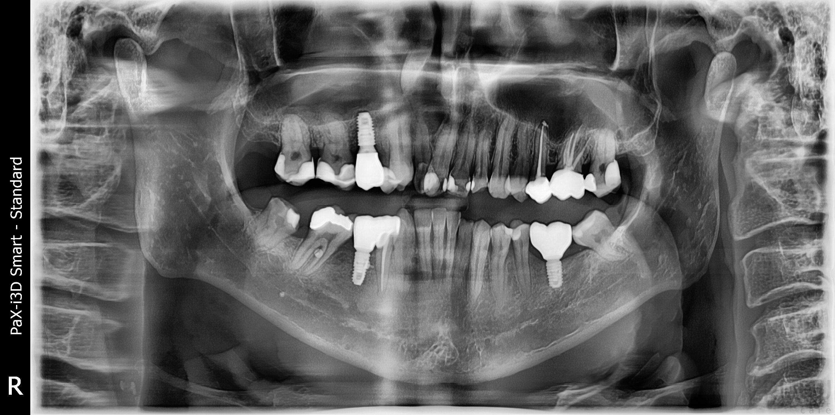 22 Best Orthodontist (Braces) Dental Clinics in Kuala Lumpur - Price