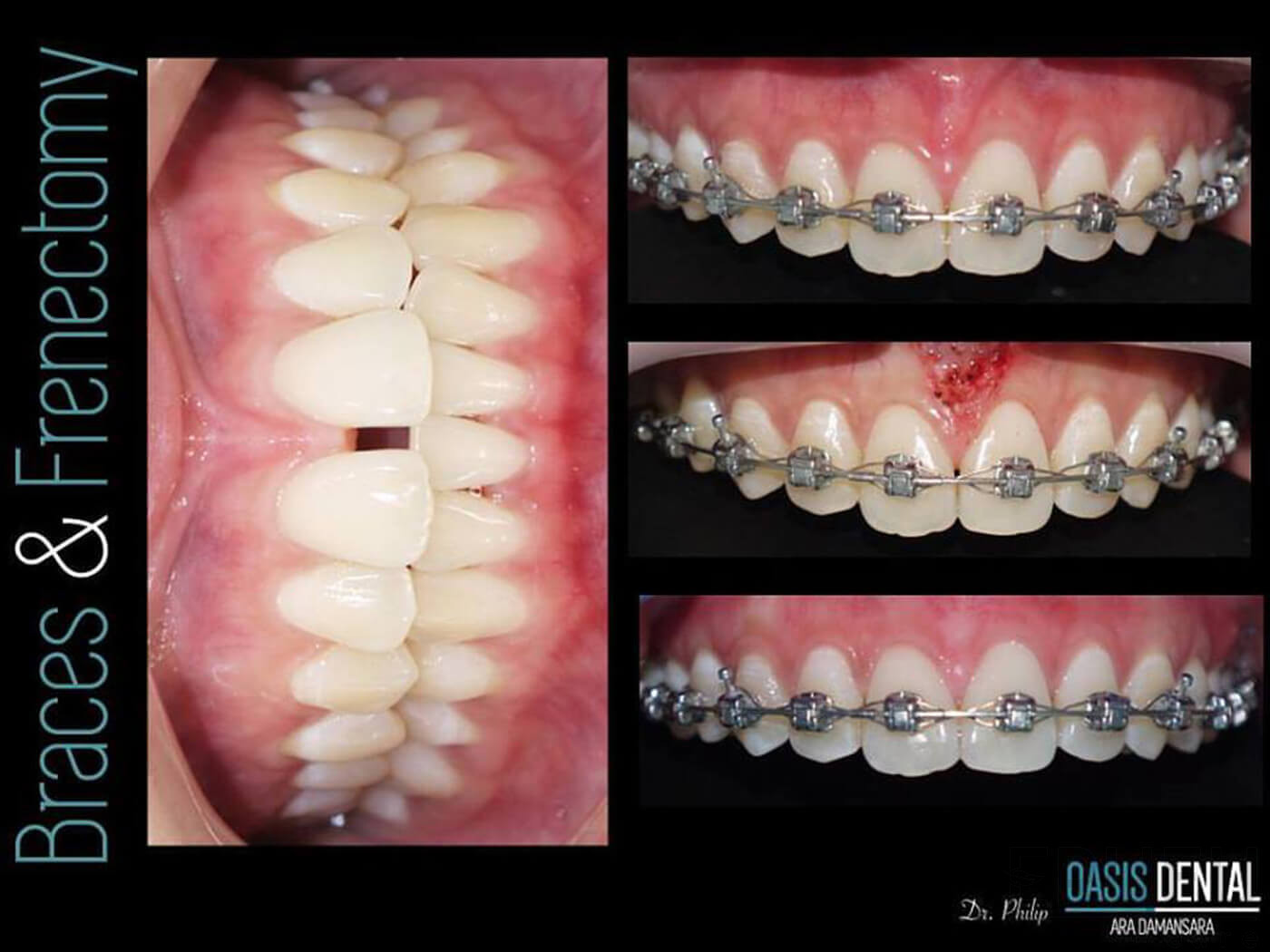 Oasis Dental Ara Damansara