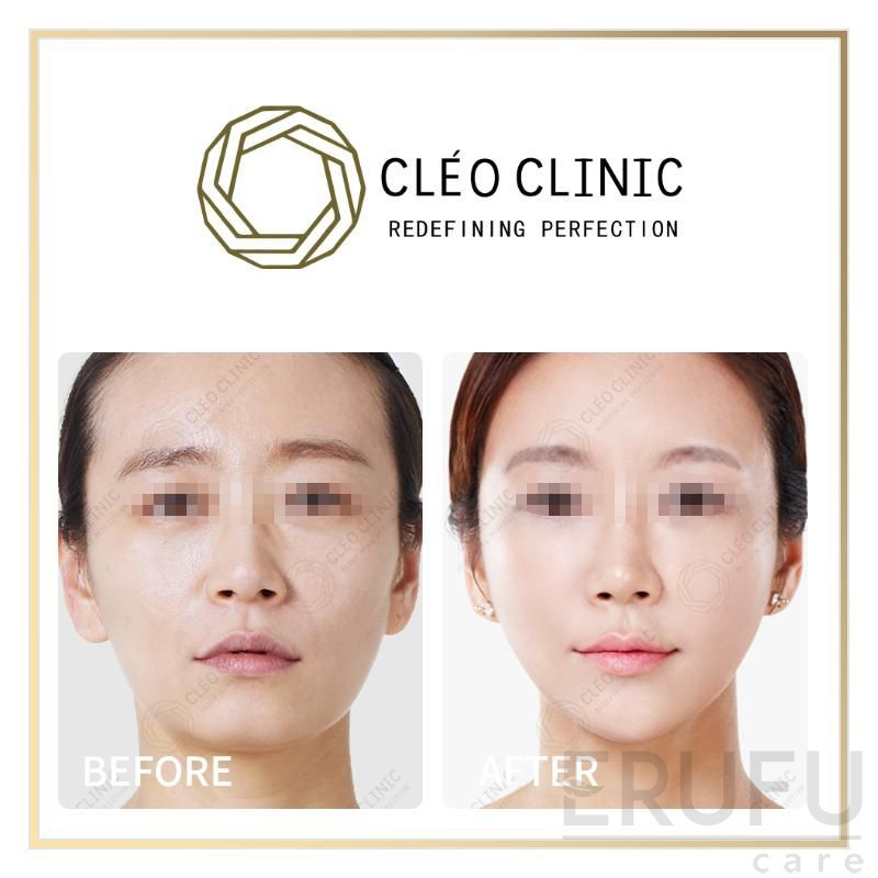 Klinik Cleo Cleo Clinic Estetik Kecantikan Dan Anti Penuaan Dermatologi Kulit Harga Ulasan Erufu Care