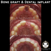 Avident Dental Clinic