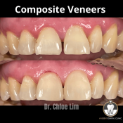 Avident Dental Clinic