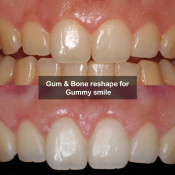 Klinik Pergigian Icon Sri Petaling (Icon Dental Sri Petaling)