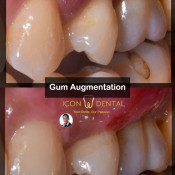 Klinik Pergigian Icon Sri Petaling (Icon Dental Sri Petaling)