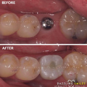 Klinik Pergigian Dazzling Smiles