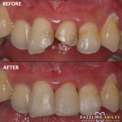 Klinik Pergigian Dazzling Smiles