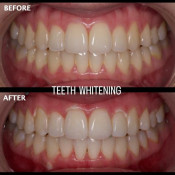 Klinik Pergigian Dazzling Smiles