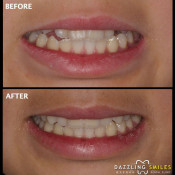 Klinik Pergigian Dazzling Smiles
