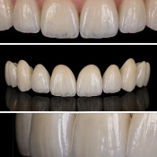 Lau Dental Clinic & Surgery (Sri Petaling)