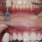 Lau Dental Clinic & Surgery (Sri Petaling)