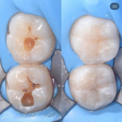 Lau Dental Clinic & Surgery (Sri Petaling)