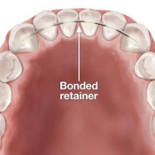 Avident Dental Clinic
