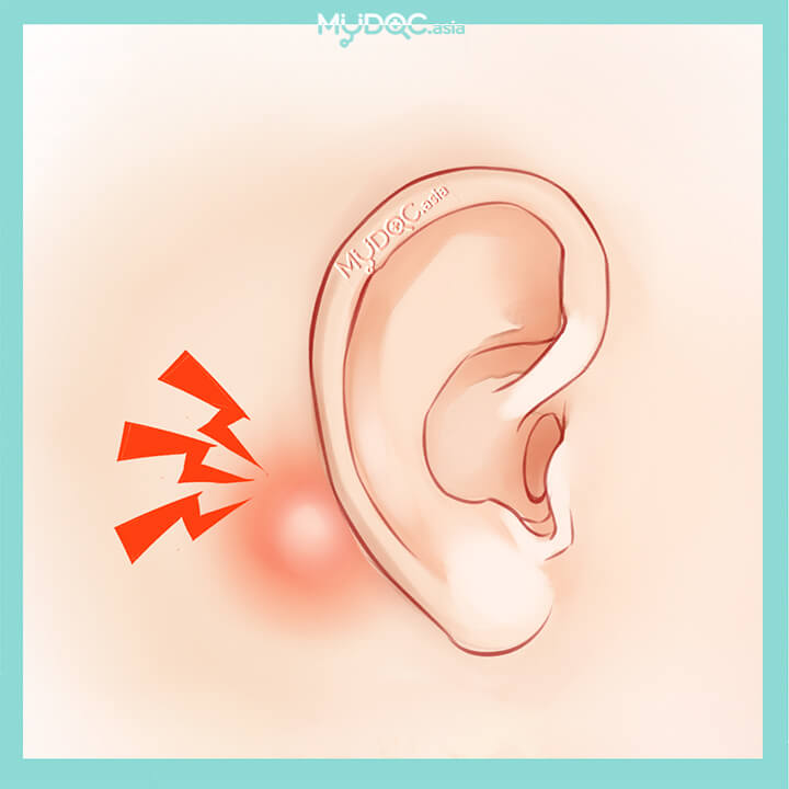 Mastoiditis Treatment